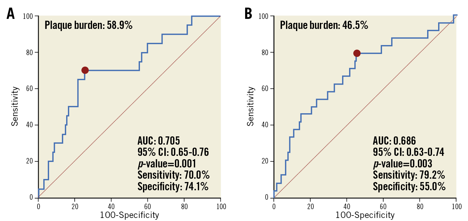 Figure 4. Receiver operating characteristic curves for intravascular ultrasound criteria of edge restenosis. A) Proximal reference segments. B) Distal reference segments. AUC: area under the curve