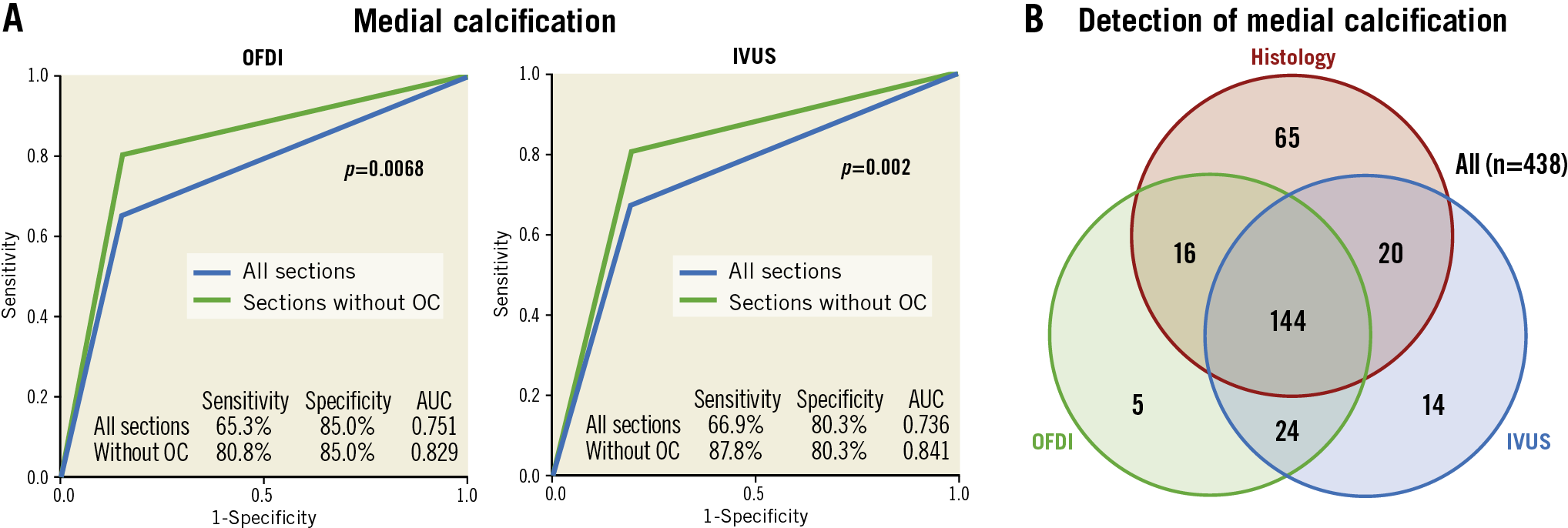 Figure 4. Detection of medial calcification by IVUS and OFDI. A) Receiver operating characteristic curve for detection of medial calcification in all sections and in sections without overlapped calcifications by OFDI and IVUS. B) Number of sections diagnosed by histology, OFDI and IVUS. AUC: area under the curve; IVUS: intravascular ultrasound; OC: overlapped calcification; OFDI: optical frequency domain imaging